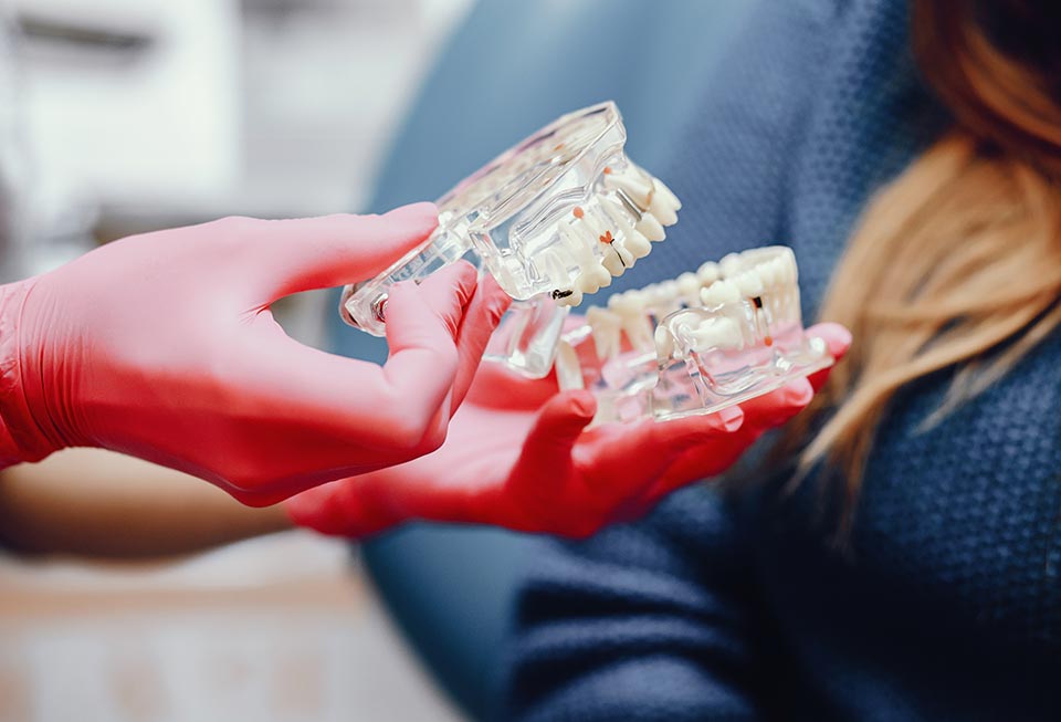 Implantes